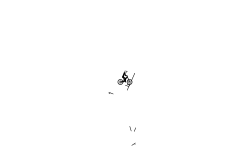 Dizziness